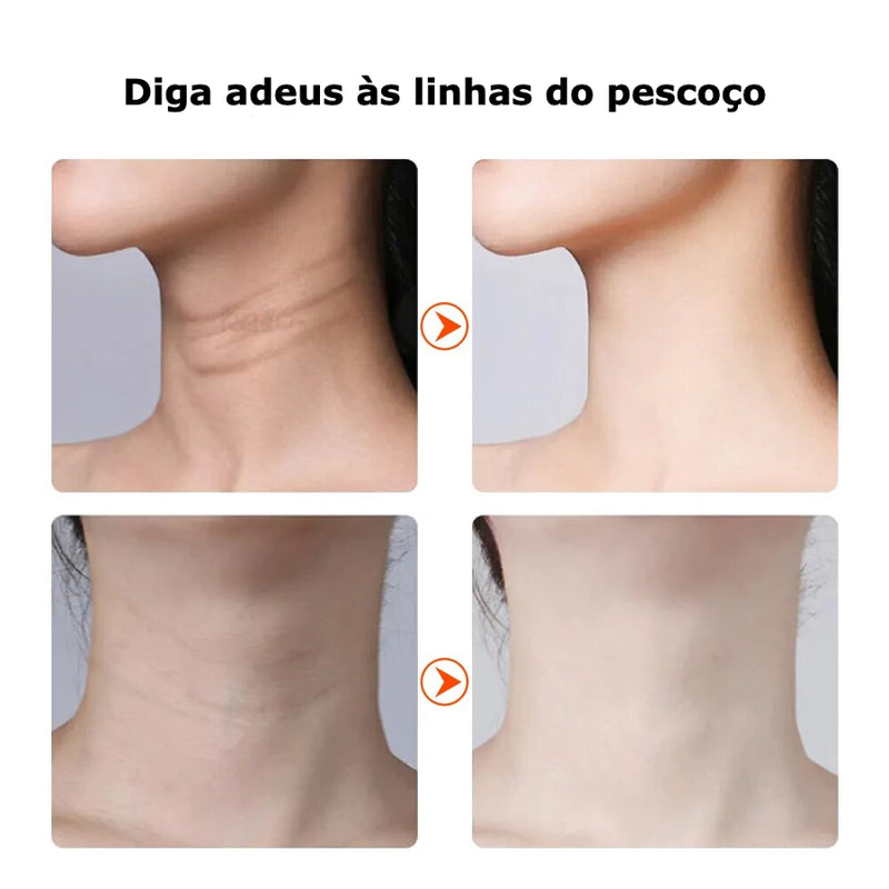 Dispositivo Anti-Rugas de Luz Pulsada