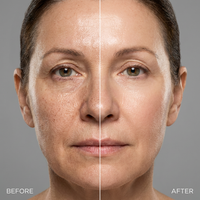 Máscara Milagrosa Removedora Pontos Negros